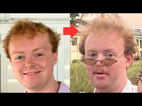 How I Lost All My Hair At 19