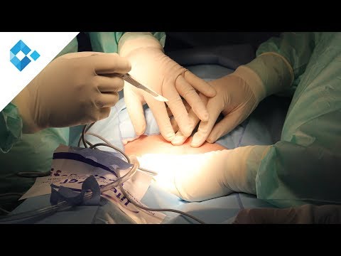 Brustwirbelsäule und der Bauchspeicheldrüse Klinik Gelenke und Osteochondrose