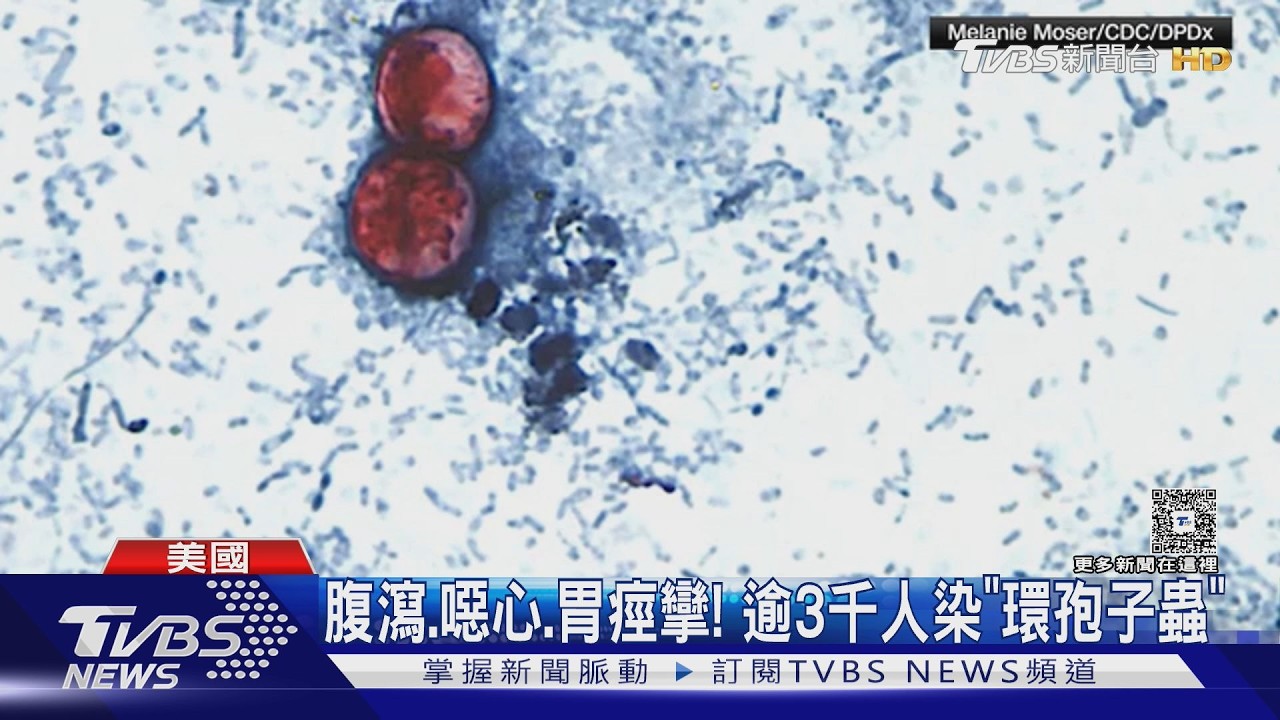 影音/漂白水也難殺? 美「環孢子蟲」疫情 疑食生菜、逾3千人腹瀉