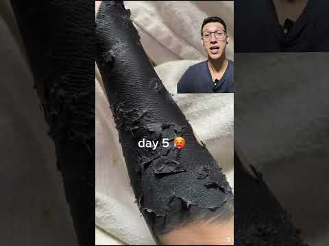 Cicatrización de blackouts #tatuajes #tattoo #cuidados