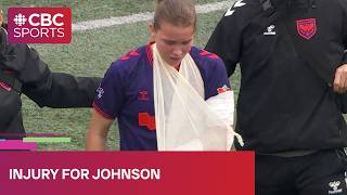 Calgary Wild midfielder Kahli Johnson forced out of Montreal game with arm injury | #CBCSports