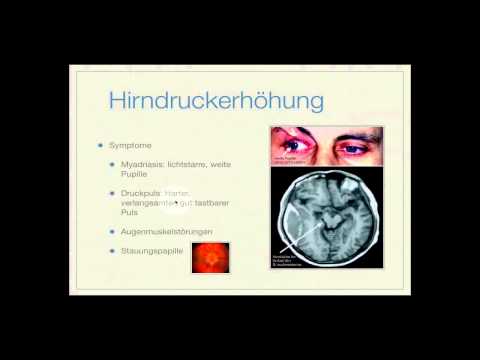 Lateinischer Name Losartan Valz n160 25
