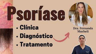 Psoríase diagnóstico e tratamento