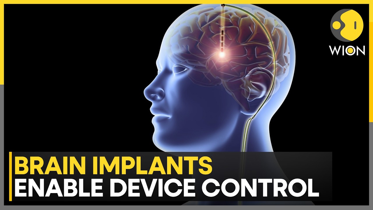 Neuralink Launches First UK Brain Chip Trial: Musk’s Mind-Control Tech Debuts In Britain | WION