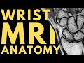 Wrist MRI Anatomy Radiology Anatomy Part 1 Prep How To Interpret A Wrist MRI