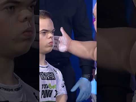 The best slap fighting contest #slapfight #fight #fighter #boxing #punch #slap #fighting #ufc #viral