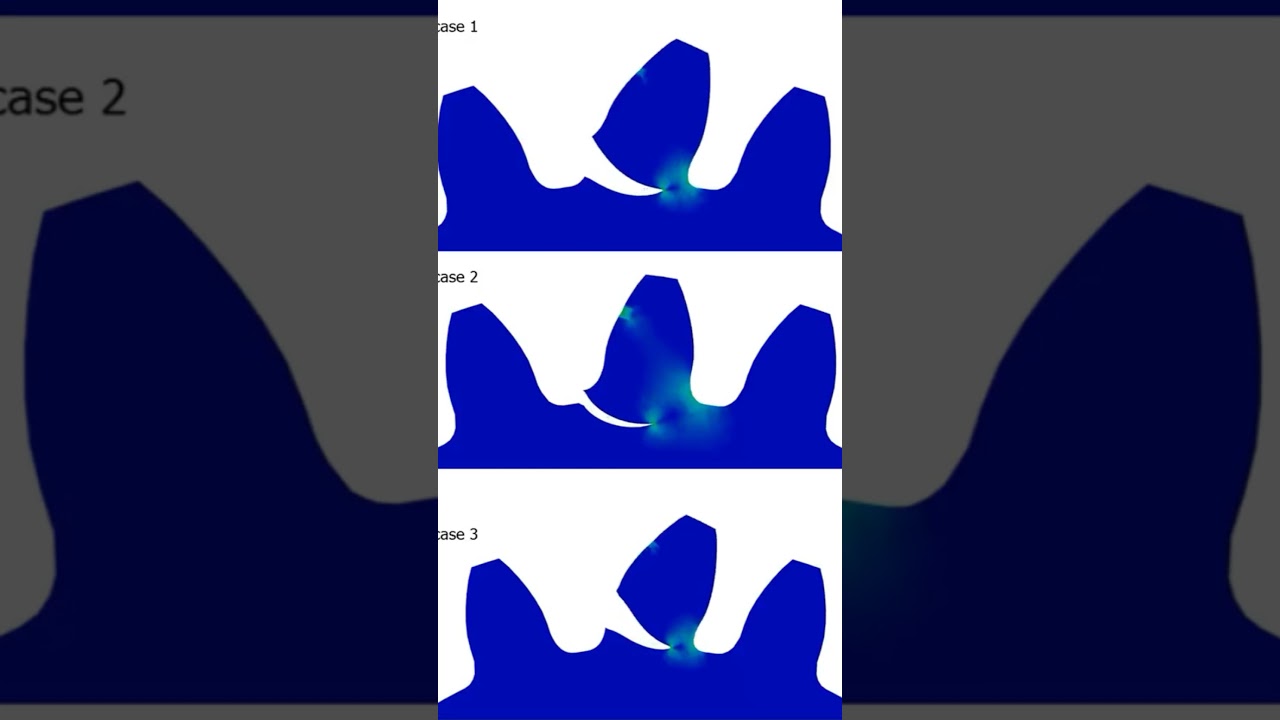 Gear tooth failure analysis