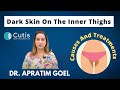 Dark Skin On The Inner Thighs Pigmentation Causes And Treatments Cutis Skin Solution