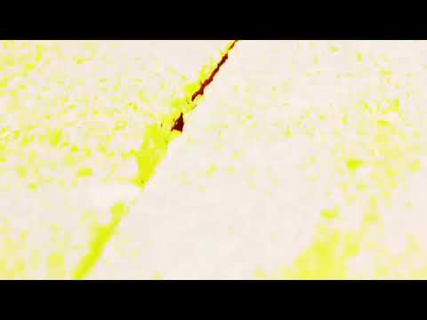 Klinac x Yungkulovski  Nova Lova