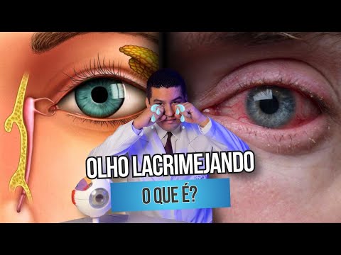 My eyes are watering, what could it be?