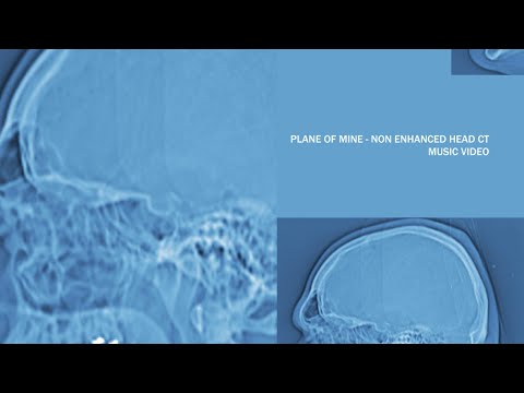 Plane of Mine - Non Enhanced Head CT (2021 HD Remaster)