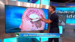 What Are The Side Effects Of Heroin & Natural Heroin Addiction Treatment!