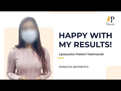 Liposuction Patient Testimonial