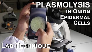 Plasmolysis in Onion Epidermal Cells - Biology Lab Techniques