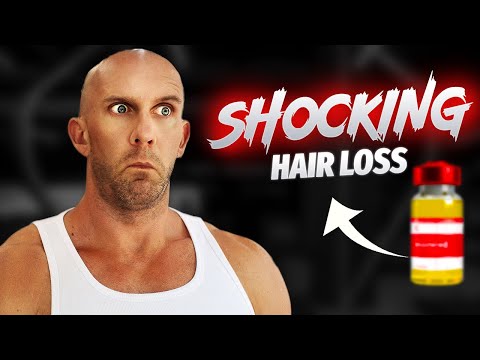 Masteron Vs Primobolan Cycle - Side Effects Benefits Results