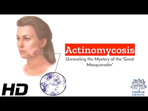 Wheat Allergy Causes Signs and Symptoms Diagnosis and Treatment