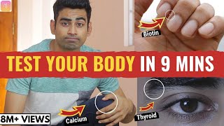 28 Signs Your Body is Deficient in Vital Nutrients (With Solution)