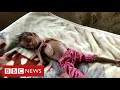 Millions of children face starvation in Yemen warns United Nations - BBC News