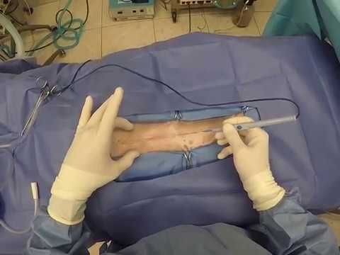 Bovie® Animal Health -  Bovie's Electrosurgery for Initial Opening 02 22 17