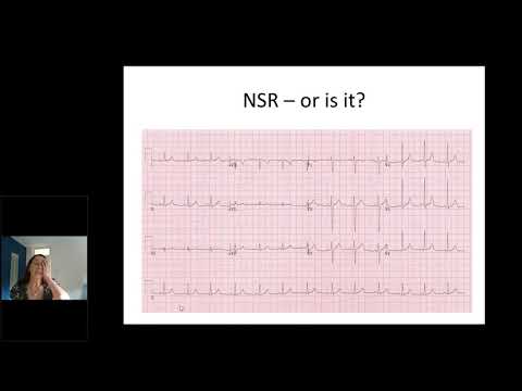 Cardiology - ECG in ED - Dr A McCorquodale - 10Nov2020