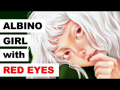 Albino With Red Eyes
