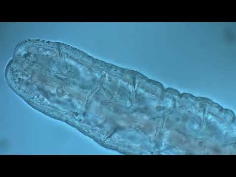 Freshwater Oligochaete