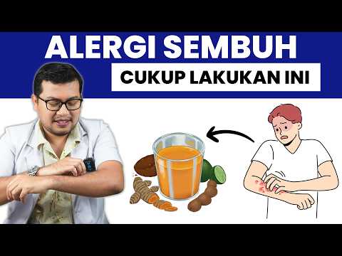 ALERGI BISA SEMBUH - DOKTER SADDAM ISMAIL
