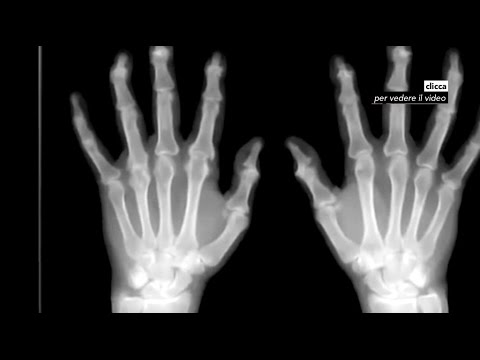 Chi cura la psoriasi in Barnaul La cera è emozionante comprare la crema da risposte di psoriasi