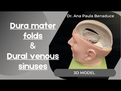 Dr. Benaduce: Dura Mater Folds & Dural Venous Sinuses - 3D Model