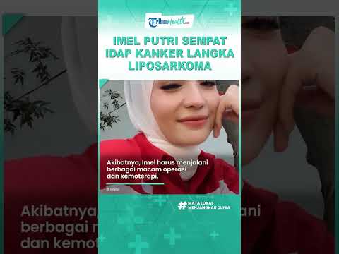 Pesinetron Drama Kolosal Imel Putri Sempat Idap Kanker Langka Liposarkoma, Ternyata Ini Penyebabnya