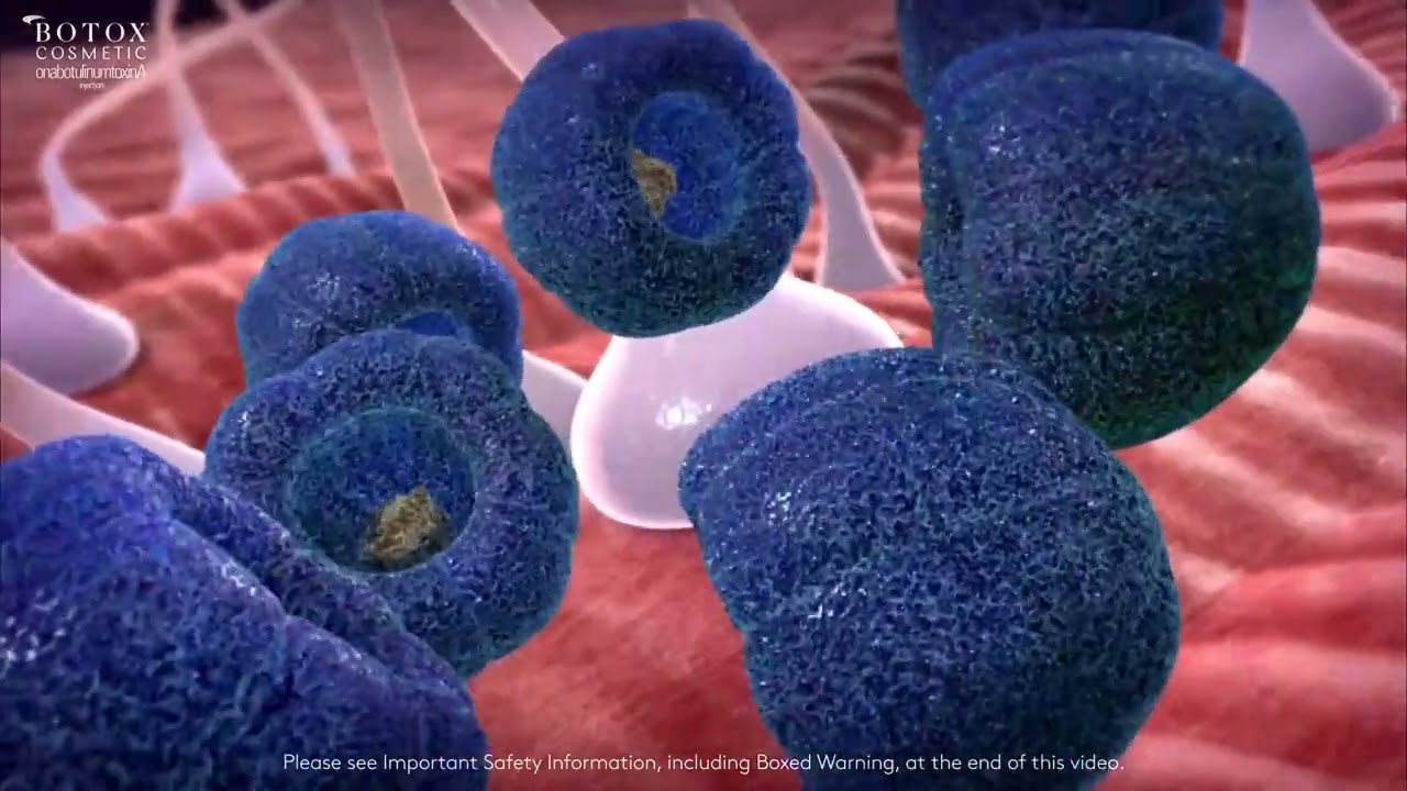 MOA Botox - What is the Mechanism of Action of Botox for Wrinkles?