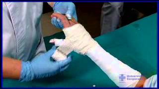 Fractura de escafoides