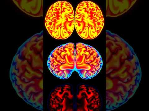 Unlocking the Secrets of Intermittent Fasting: Benefits for Body & Brain 🌟