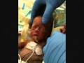 14 ounce, micro-preemie Faith. God's Miracle ...