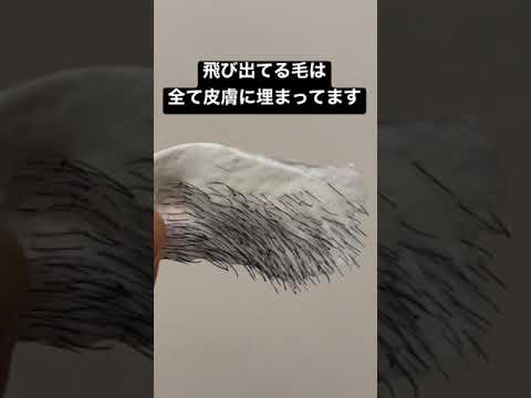 脱毛:専門家は2つの具体的な理由を警告 - 多くの人が知らず知らずのうちに影響を受けている