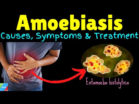 Amoebiasis | Amebiasis | Amoebic Dysentery – Symptoms, Causes, Treatment, Complications, Preventions