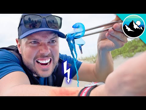 STUNG by a Man O' War Jellyfish!