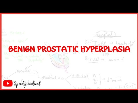 Prostatitis támadja meg mit tegyen