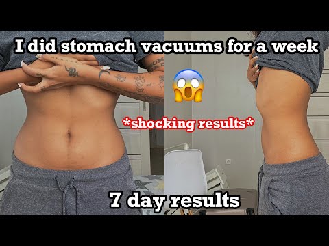 I did stomach vacuums for a week & Here’s what happened￼ 😱￼