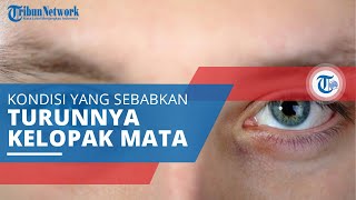 Sindrom Horner, Kondisi Adanya Kerusakan Jaringan Jalur Saraf yang Berjalan dari Otak ke Wajah