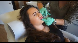 MIJN LIPPEN LATEN OPSPUITEN! Vlog #8 | Lindsey Fontani