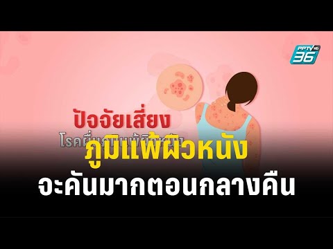 1 นาทีสุขภาพดี กับ BDMS ภูมิแพ้ผิวหนังจะคันมากตอนกลางคืน  | โชว์ข่าวเช้านี้ | 27 ธ.ค. 66