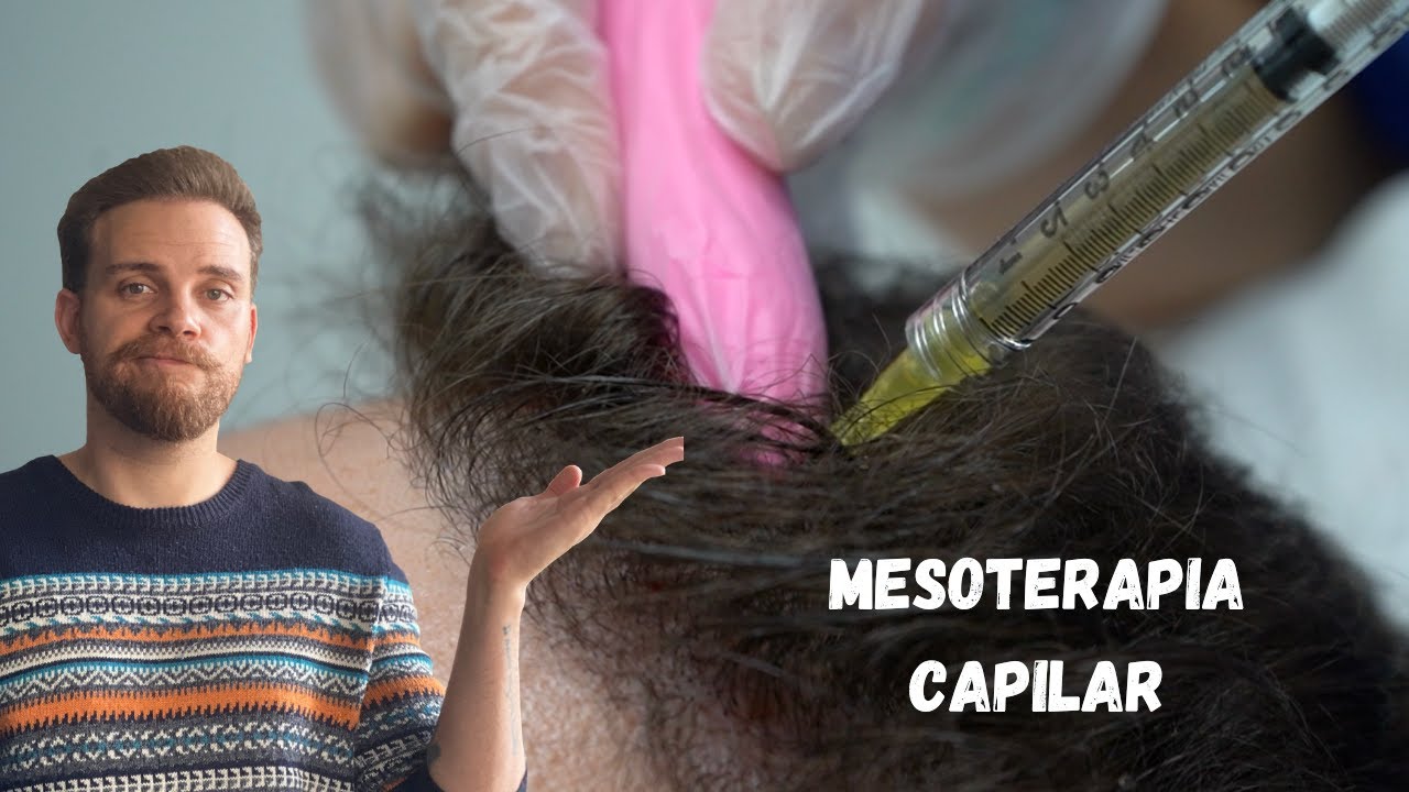 ¿FUNCIONA LA MESOTERAPIA CAPILAR