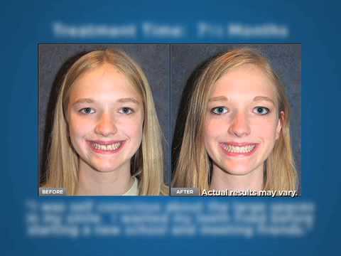 Invisalign Lobby Video - Ginger Hansen, DDS