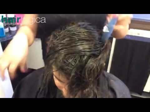 Hair Replacement Procedure at Hair Logica