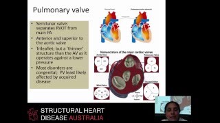 Pulmonary valve pathology and echocardiographic assessment – Dr Liza Thomas