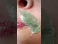 Upper Lip Wax At Home