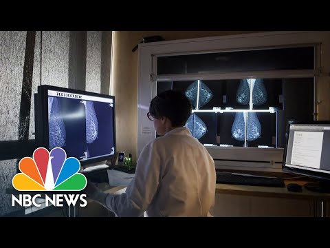 Women should get screened for breast cancer at 40 rather than 50, new guidelines say
