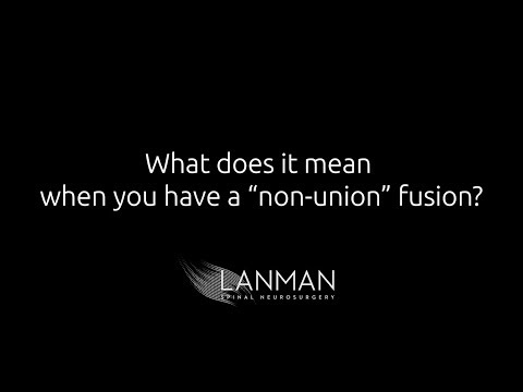 What does it mean when you have a "non-union" fusion? | Dr. Todd Lanman