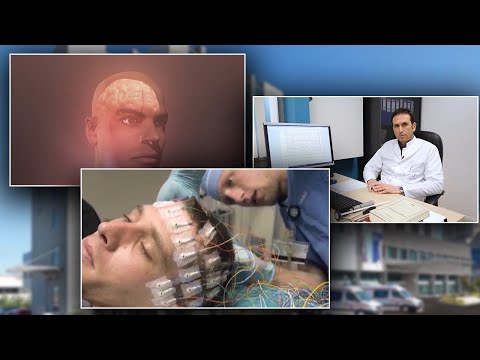 COVID-19 mund te shoqerohet me kriza epileptike| ABC News Albania
